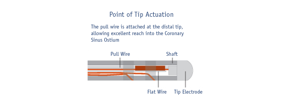 Point of Tip Actuation Image